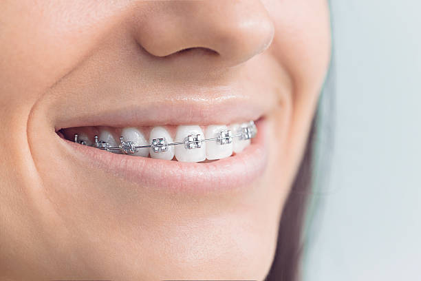 Best Invisalign and Clear Aligners  in Celina, TN